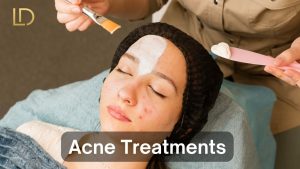 A women taking acne treatments at clinic