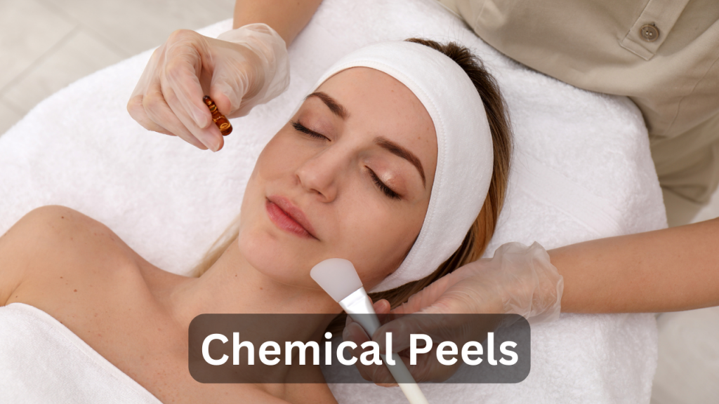 chemical peels treatment