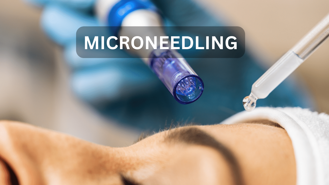 Microneedling treatment at Lucid