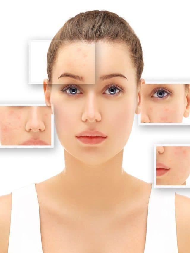 Dermatologist
