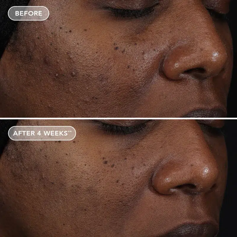 AGELESS-retinol_B-A_RepairCreme_Subject31