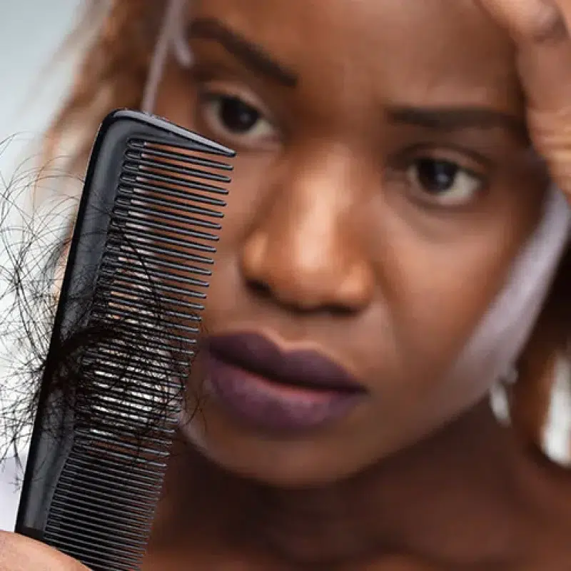 Hair Shedding