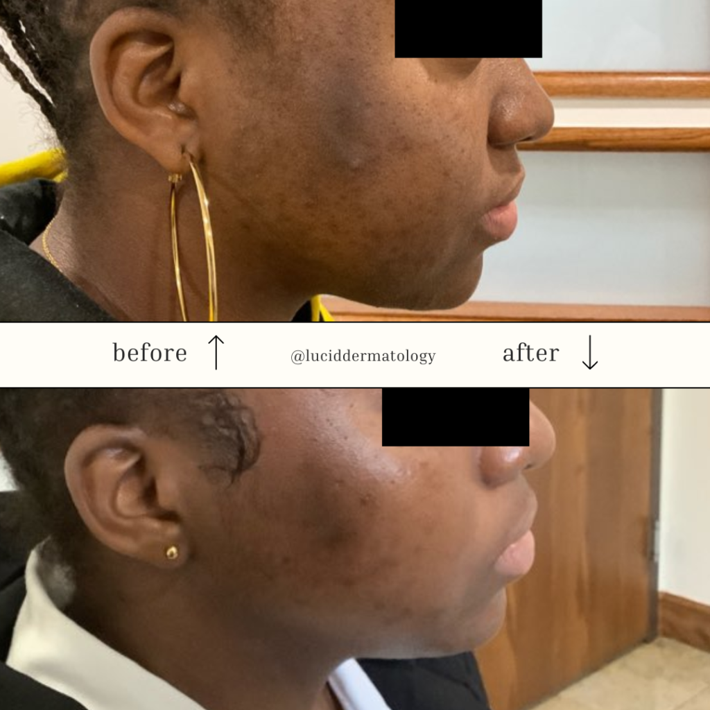Before and After Image: Case 2 - right-side