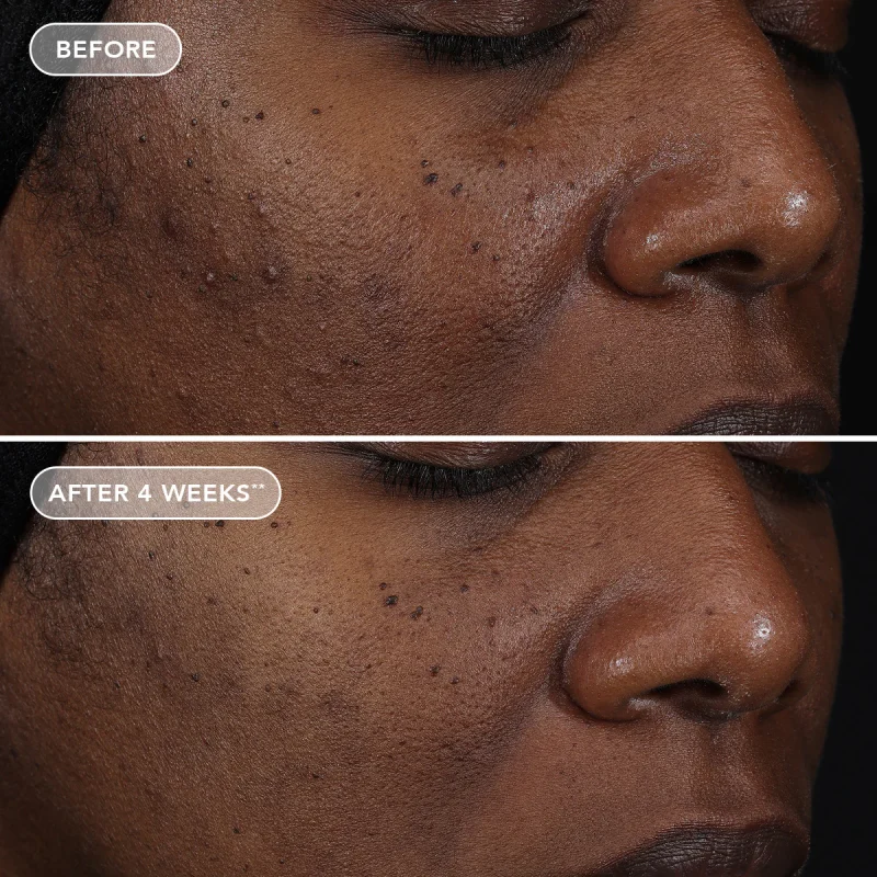 AGELESS-retinol_B-A_RepairCreme_Subject31