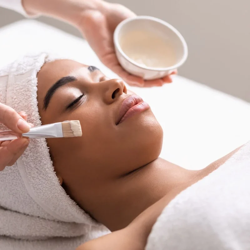 Chemical Peel