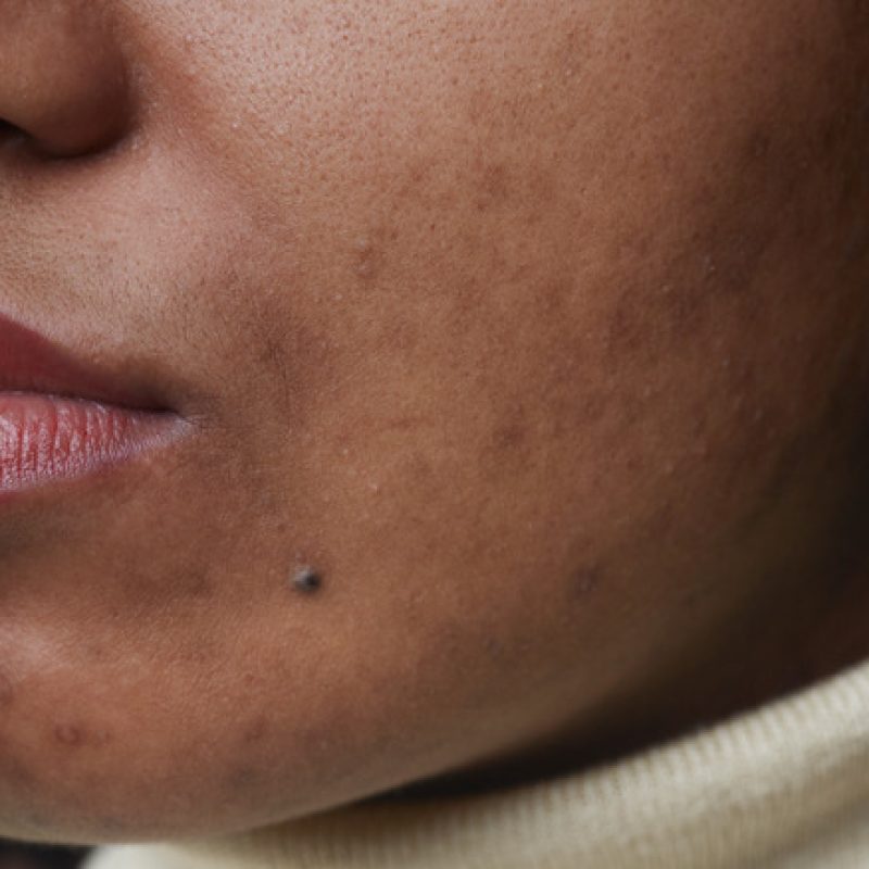 Extreme,Close,Up,Portrait,Of,Real,African,American,Woman,With