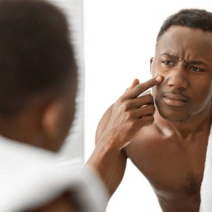 Problem Skin. Sad African American Man Touching Acne Pimple On Face Looking At His Reflection In Mirror Standing In Modern Bathroom At Home. Dermatology, Male Facial Skincare Concept. Selective Focus