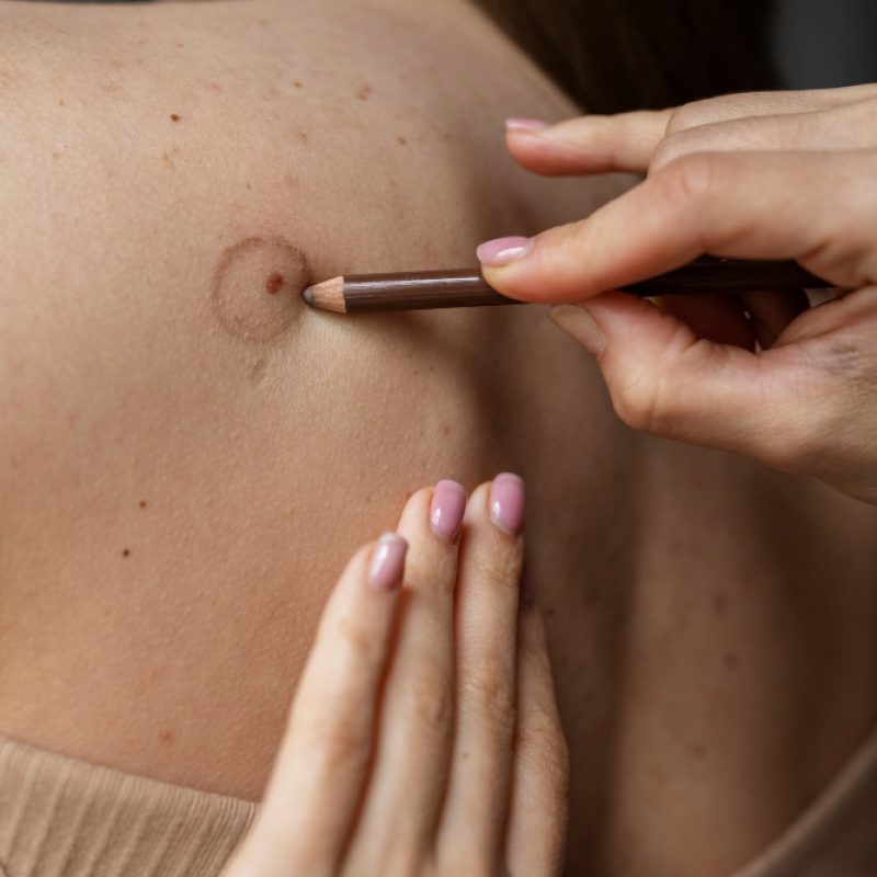 Skin Exam Routine