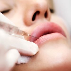 lipFiller-938782572-770x553-650x428